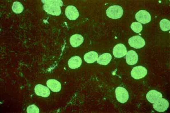 Mycoplasma-infected cells (Hoechst 33258 staining).