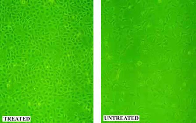 Vero cells grown on treated vs untreated plates (phase contrast).